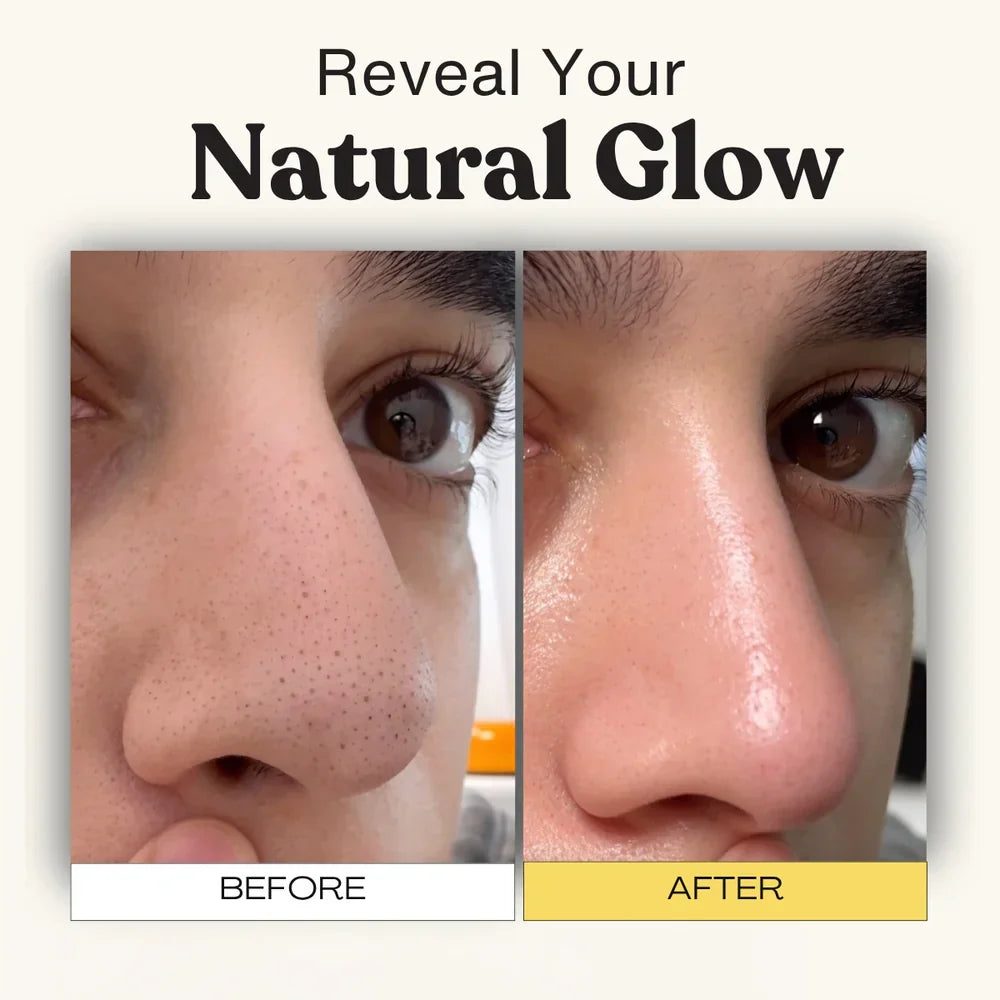 Deep Cleansing Patch System