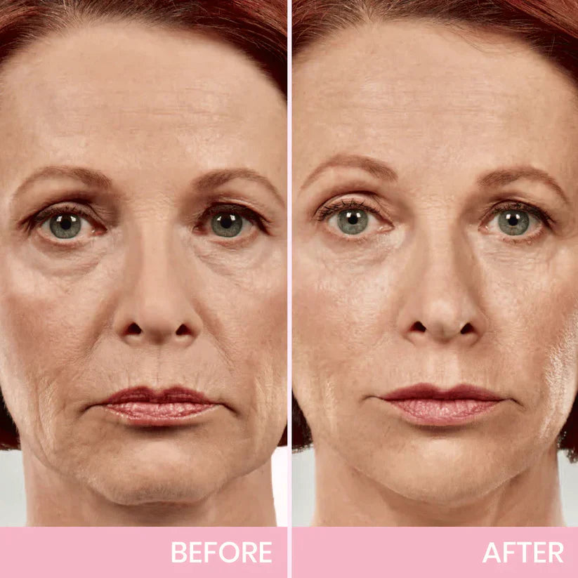 V-Face Lifting Invisible Adhesive Tape